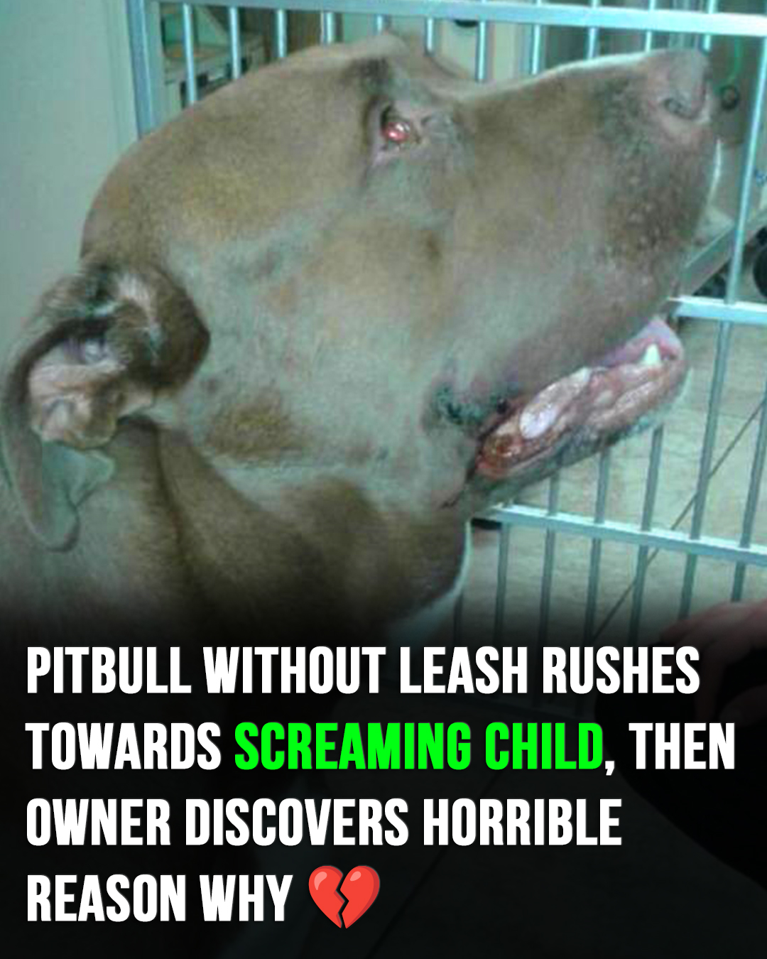 Pitbull without a leash rushes towards screaming child, then owner discovers horrible reason why