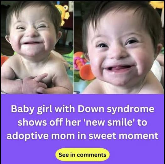 Adopted Baby With Down Syndrome Warms Hearts Worldwide With Her Radiant Smile…