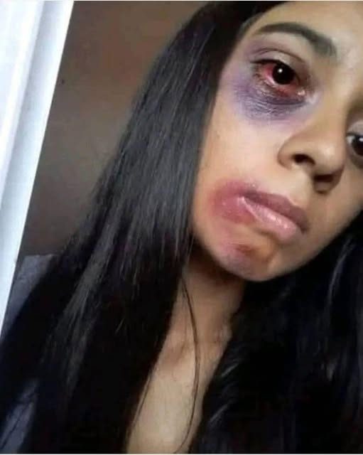 Young woman dies at the hands of her…