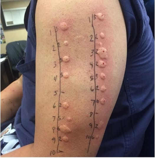 These are the consequences of sleeping co! See more