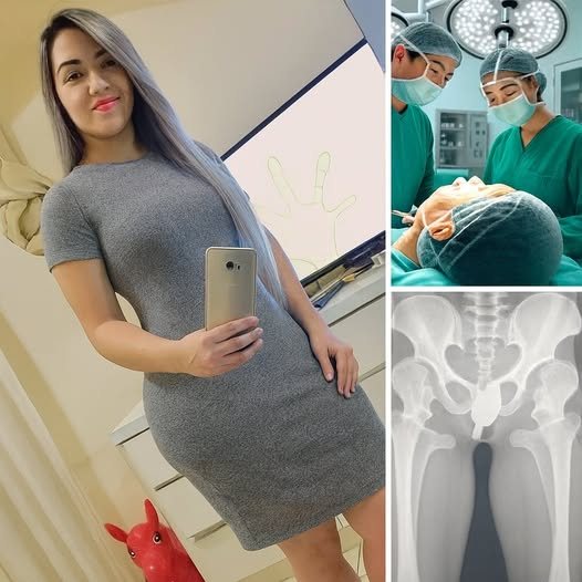 . Girl had to be hospitalized for wanting to use a pe…See more