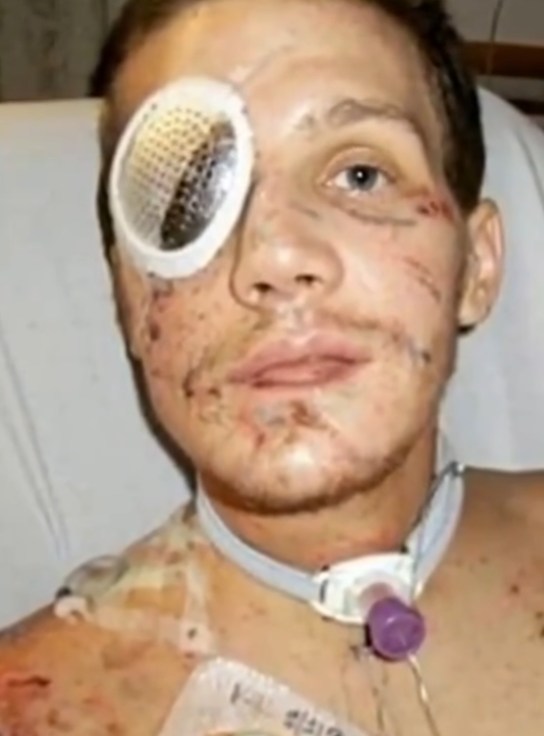 Brave Marine jumps on grenade and saves fellow comrade – wins Medal of Honor