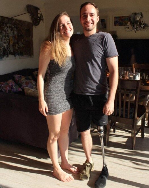 My Girlfriends Mom Damaged My $7,000 Prosthetic Leg Because Her Daughter Was Upset I Didnt Take Her on a Trip – Big Mistake