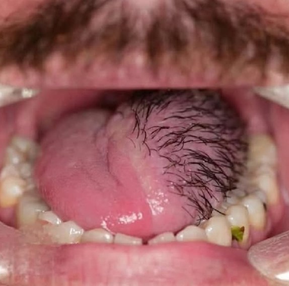 These are the consequences of sleeping with…See more