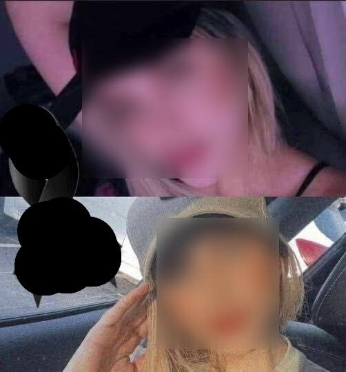 A 22-year-old girl passed away after undergoing plastic surgery and leaves…. See more