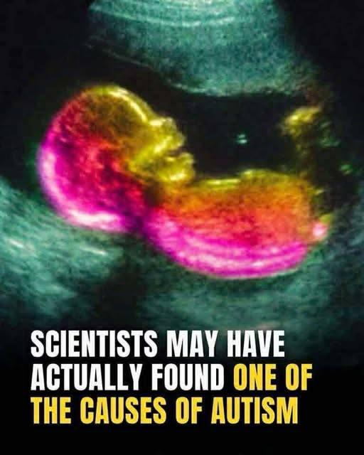 Could a Mother’s Gut Bacteria Affect Autism Risk? New Research Explores the Link